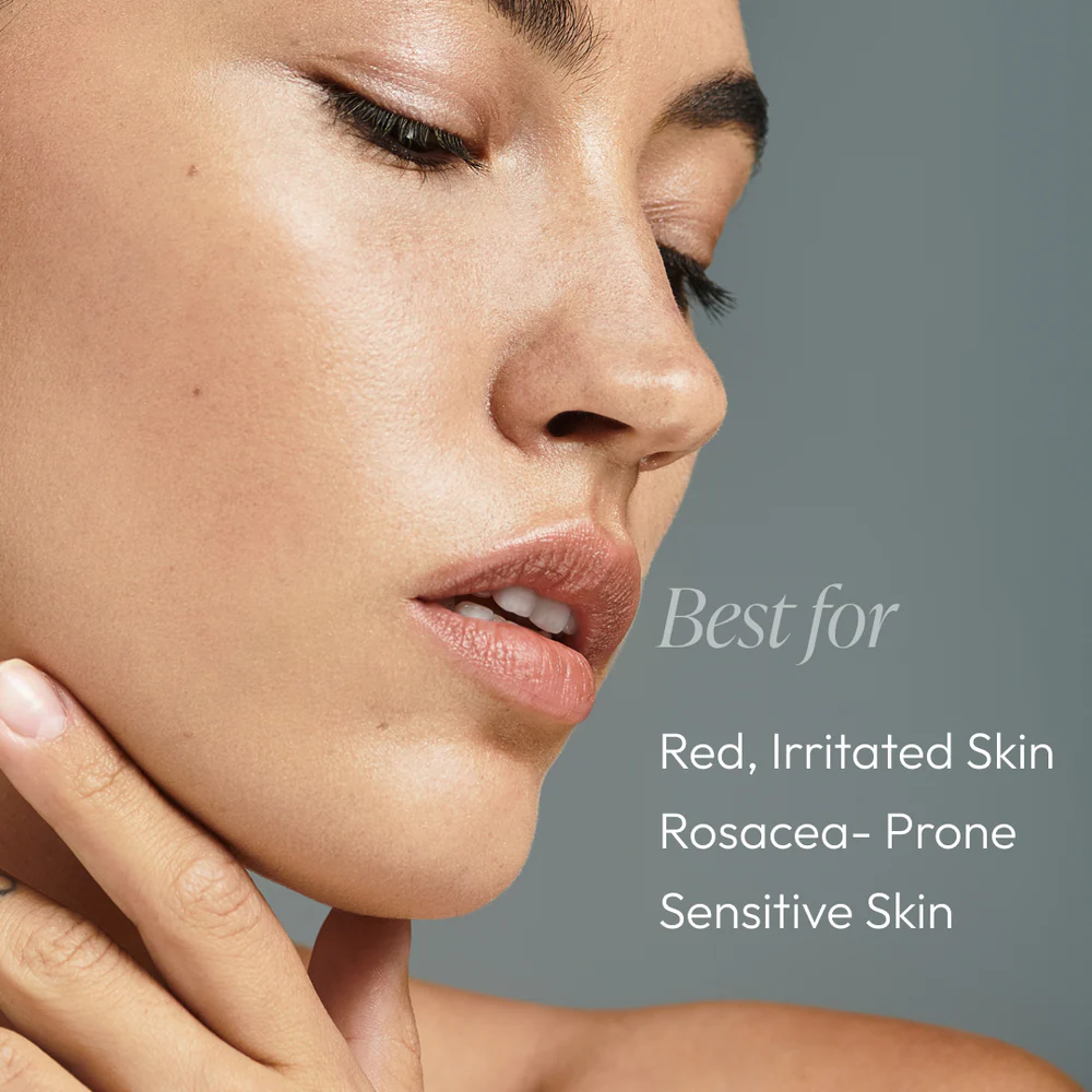 Rose-Ease Relief Cream 1.7oz