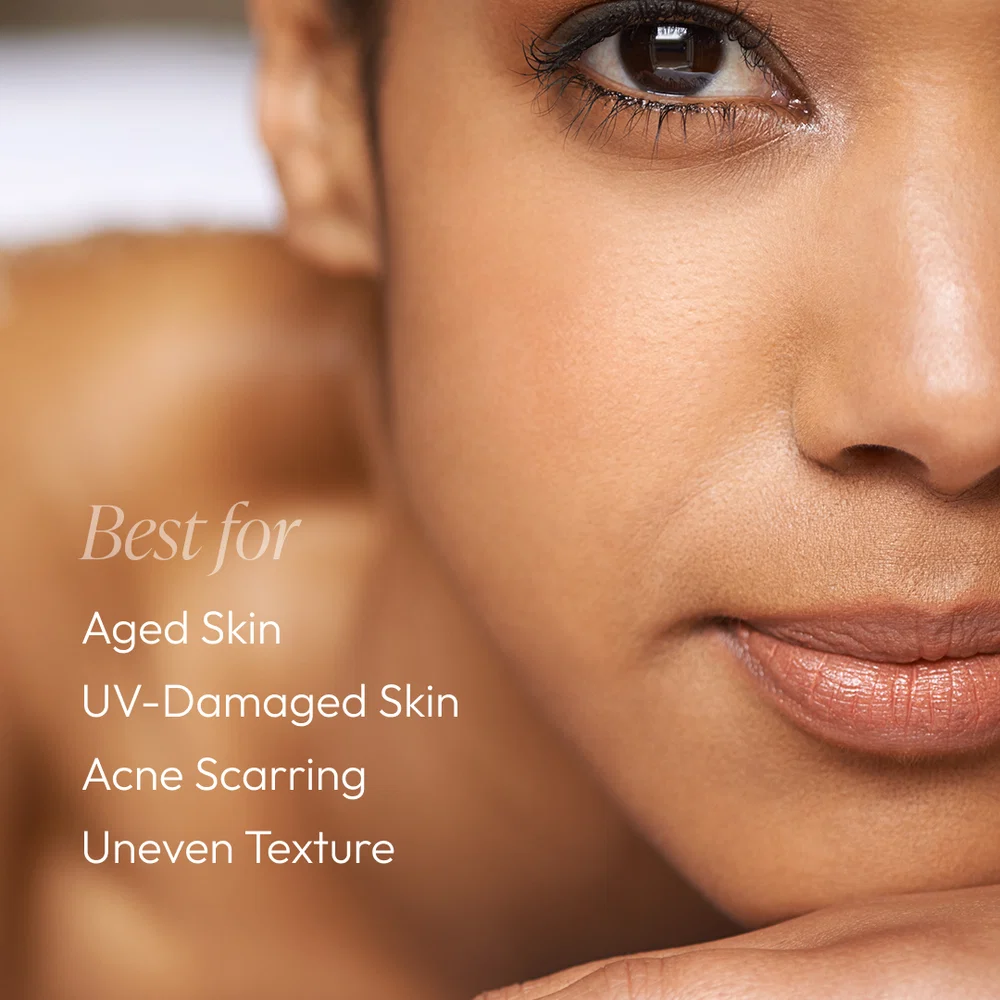 Vitamin A Gel 1oz